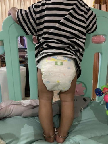 ขาโก่งมั้ยคะ?????