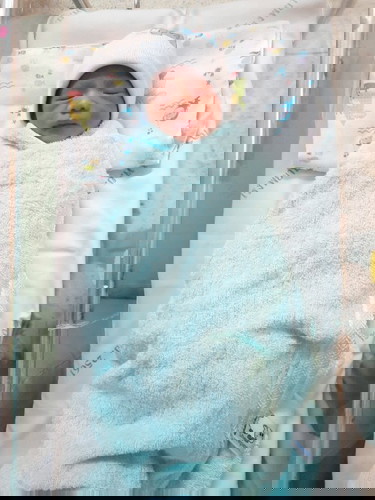 คลอดแล้วจ้า แฝดชาย ชาย ก่อนกำหนด 1 เดือน ผ่าคลอด