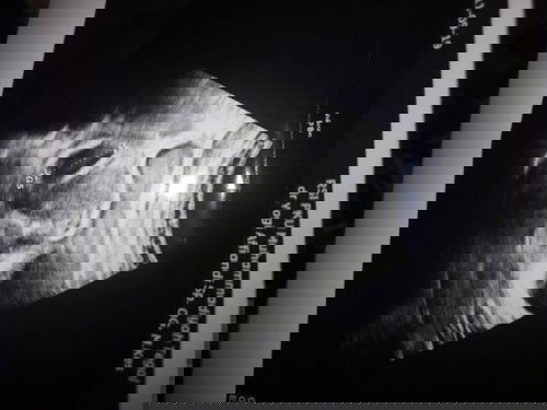 Usia 8 Minggu, janin belum kelihatan