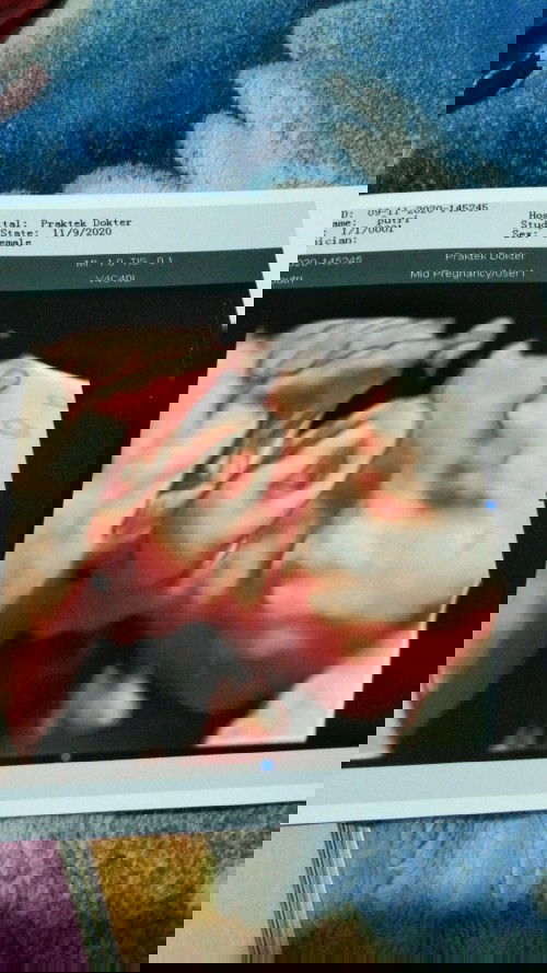 kehamilan