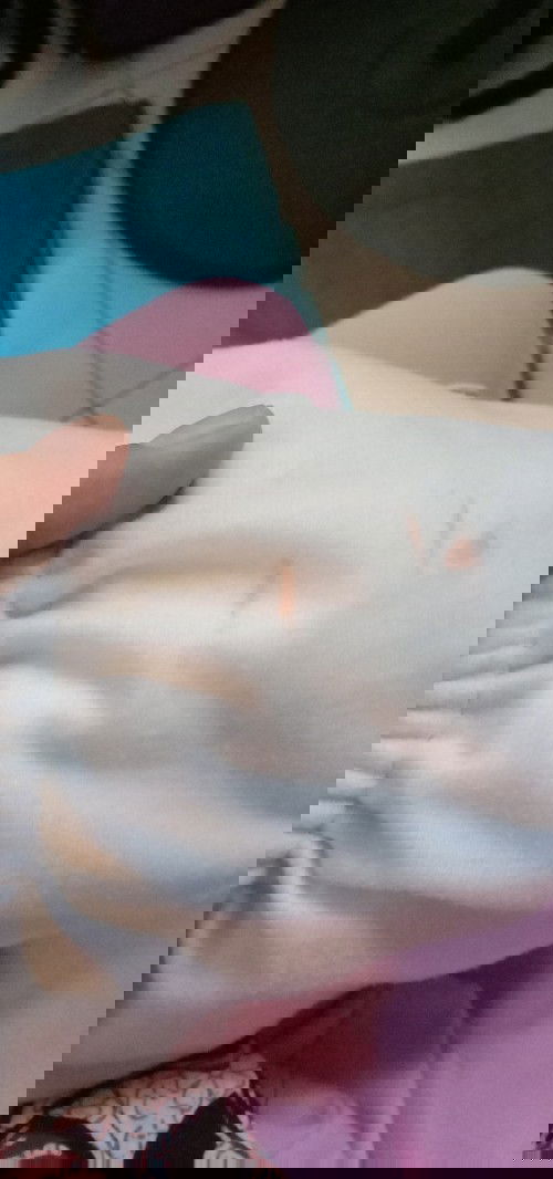 bercak merah di popok bayi