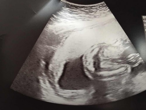 ยังไม่ทราบเพศ🤰🏻