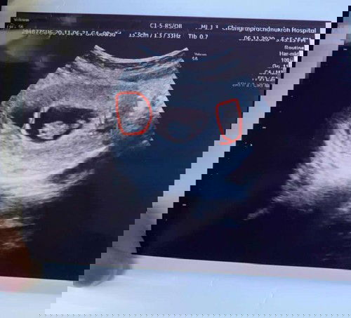 สอบถามใครเคยเป็นหรือเป็นแบบนี้บ้างคะ?