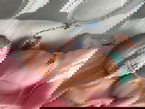 #ปอดอักเสบหายใจเร็ว