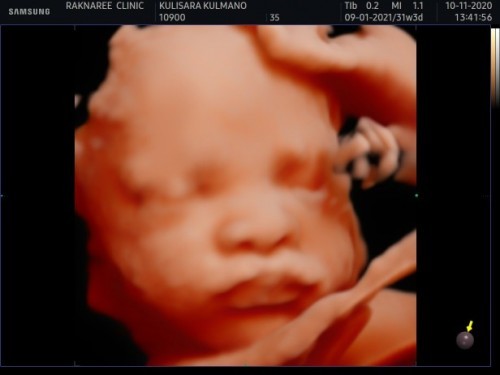 31 W 3 D