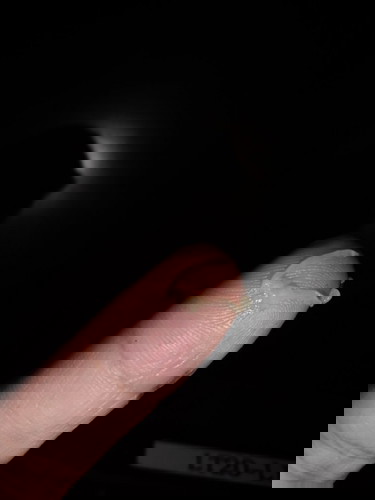 Jelly-like Discharge at 26 weeks