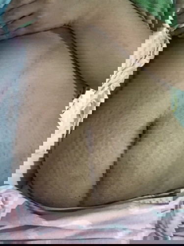 STRETCHMARKS