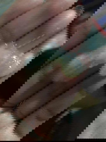 มีมูกใสออกมาต้องไปโรงพยาบาลมั้ย?