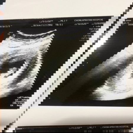 สอบถามแม่ๆหน่อยคะ