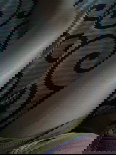 Goresan perih, panas, gatal