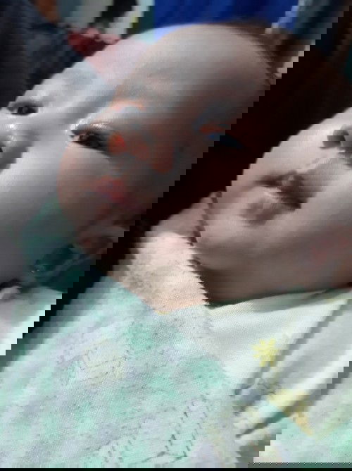 Muka bayi bintik bintik