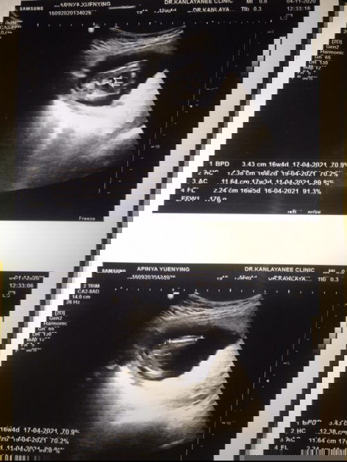 ทีมเมษายน64