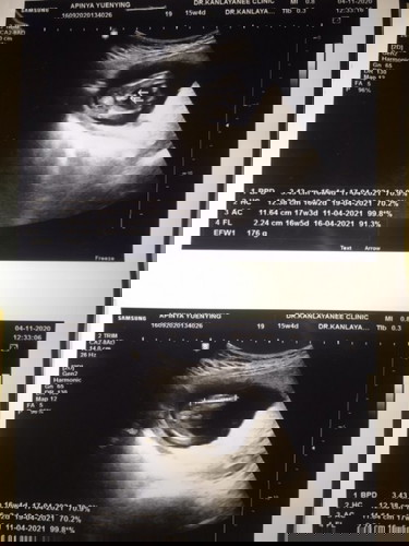 ทีมเมษายน64