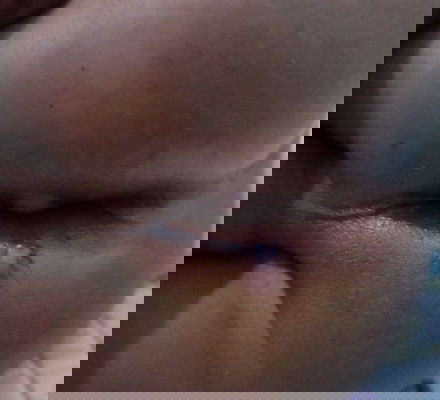 WARNING❗❗❗ tolong kalau merasa jijik silahkan skip/jangan dibuka