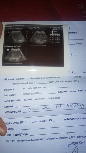 Gagal promil