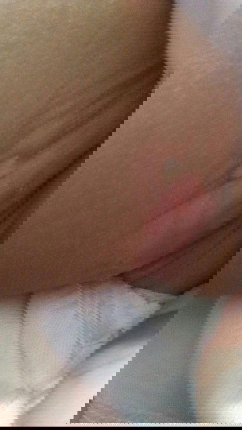 diselangkangan baby ada bercak air