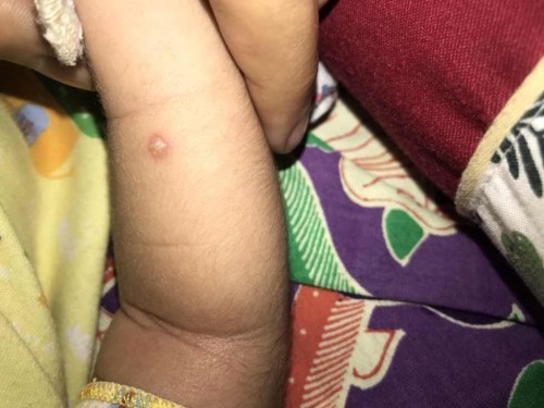 Cara obatin ini gimna?