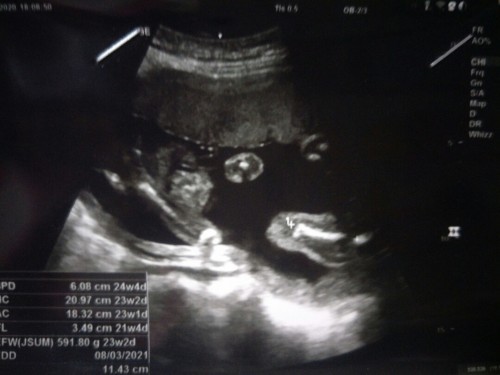 คุณแม่ท้องแรกค่ะ 👶❤