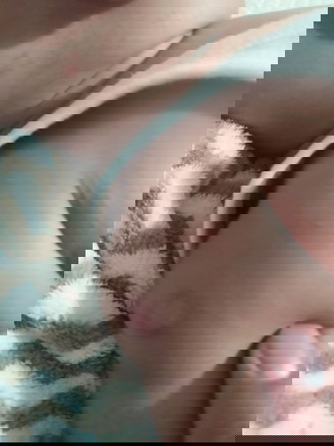 Menonjol di bagian pasca suntik