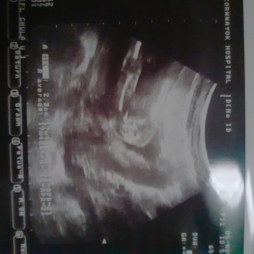 ช่วยดูเพศลูกหน่อยนะคะ