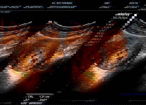 Berharap jadi ibu 😢