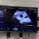 Post reply image