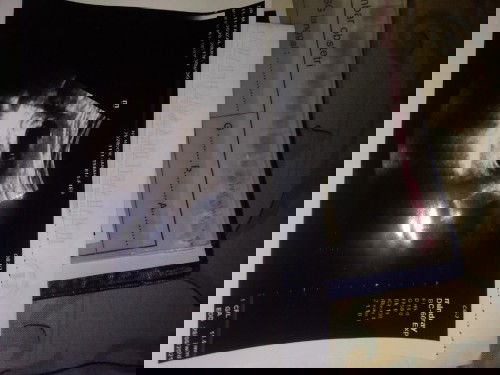 Kehamilan kosong lagi yang ke 3