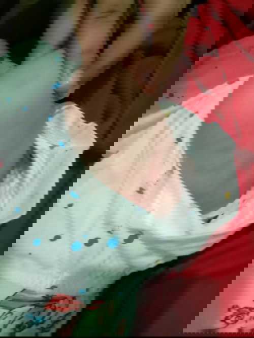 Bingung mau diobatin pake apa