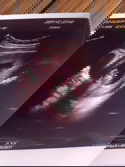 Usia periksa dan USG beda☹️