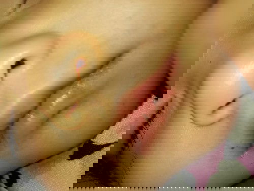 Rashes??? 
Mga mommies help, 
Pure BF is baby ko, bakit po kayo namumula paligid ng mouth nya?