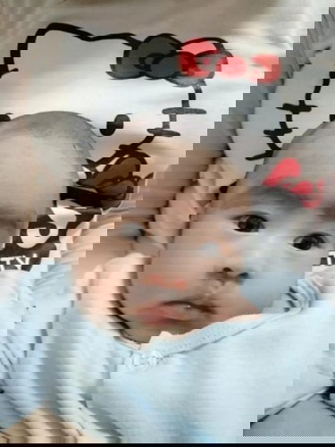 โกนผมไฟ  (คลอด 8 ตุลาคม 63)