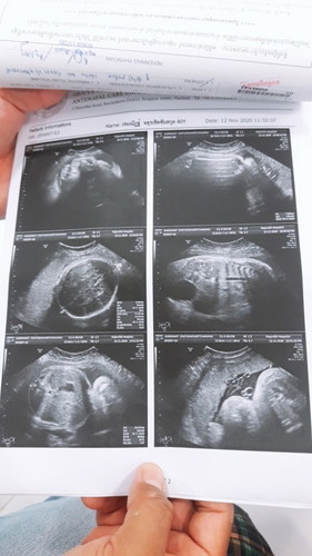 ความดันสูง