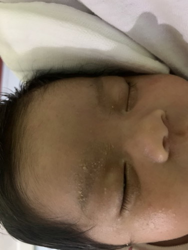 Nagbabakbak sa kilay ni baby