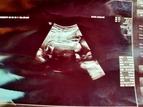 Boy @ girl.. tlg bantu yer... Xpandai nk tgk..😌