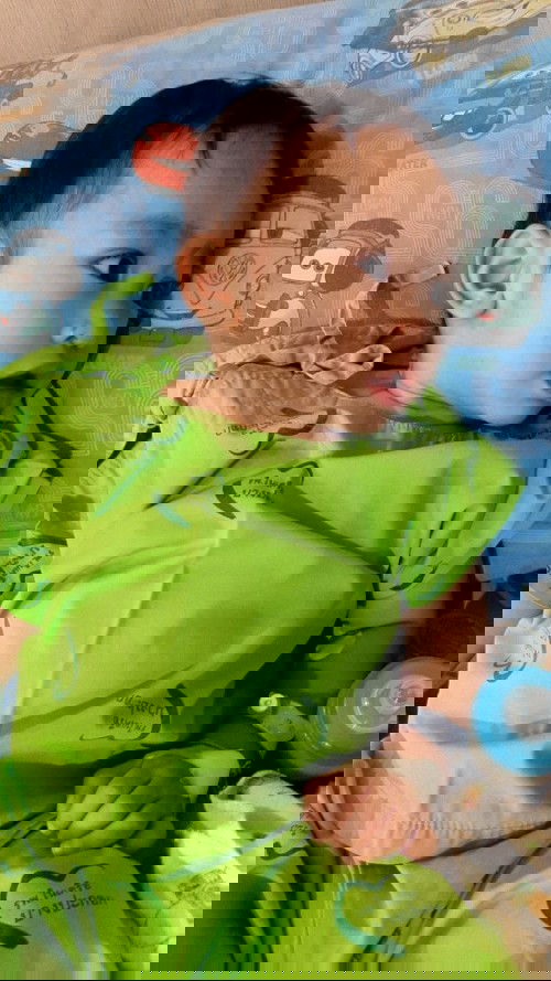 RSV ตัวร้าย