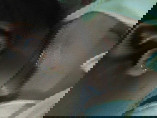 Bintik- bintik merah