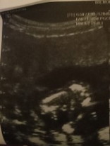 อยากทราบว่าน้องเพศอะไรค่ะ