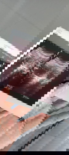 Doakan saya bunda π€