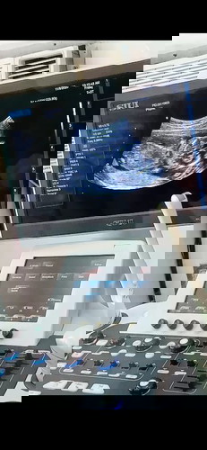 19 weeks preggy ❤️