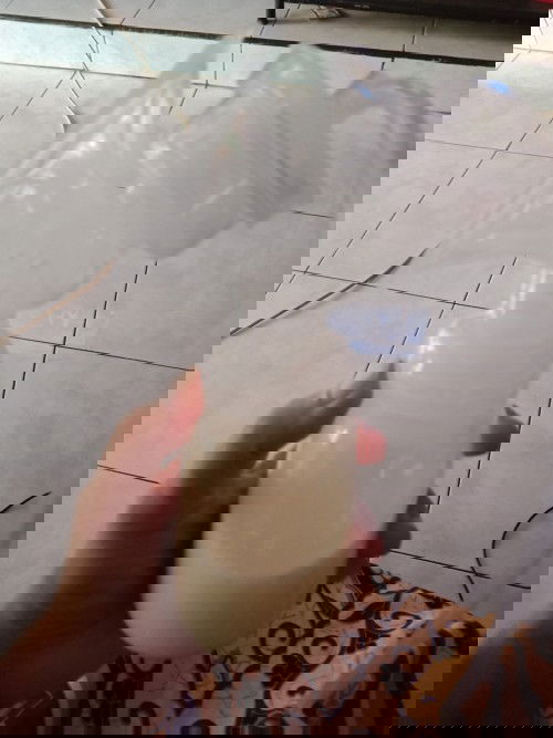 PD bengkak asi banyak