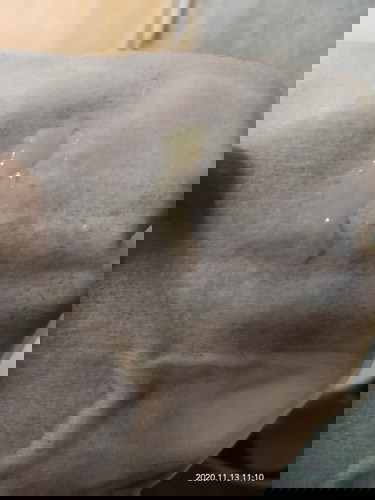 MUCUS PLUG