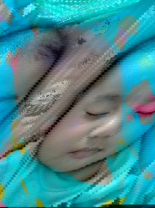 บนหน้าผากลูกมีสีขาวดังรูปเกิดจสกอะไรค่ะ