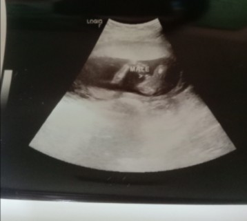 Sure na po kayang baby boy sya??