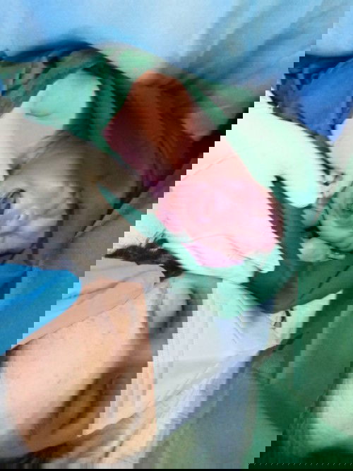 Thank You, Lord! (10 Days Inactive Labor & 12 Hours Active Labor) YLIAZ is BORN