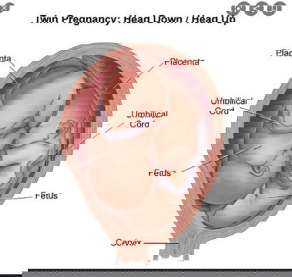 Twins Baby Girl Preggy