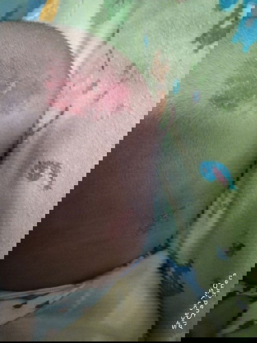 Merah di kepala bagian belakang