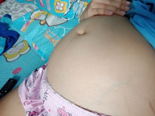 ท้องได้20week1day