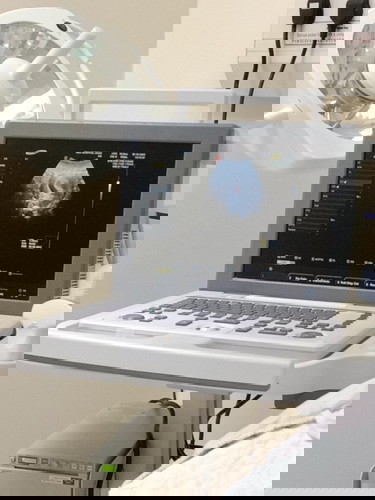 Mengandung kantung kosong