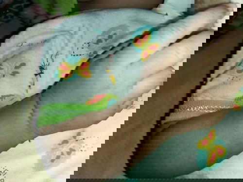 Badan bayi merah merah bulet bulet