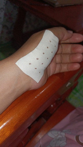 asl subuh je mesti bgian nie krem cam kena cucuk jarum😰knpaa yaa kedua belah tapak tangan ...20week